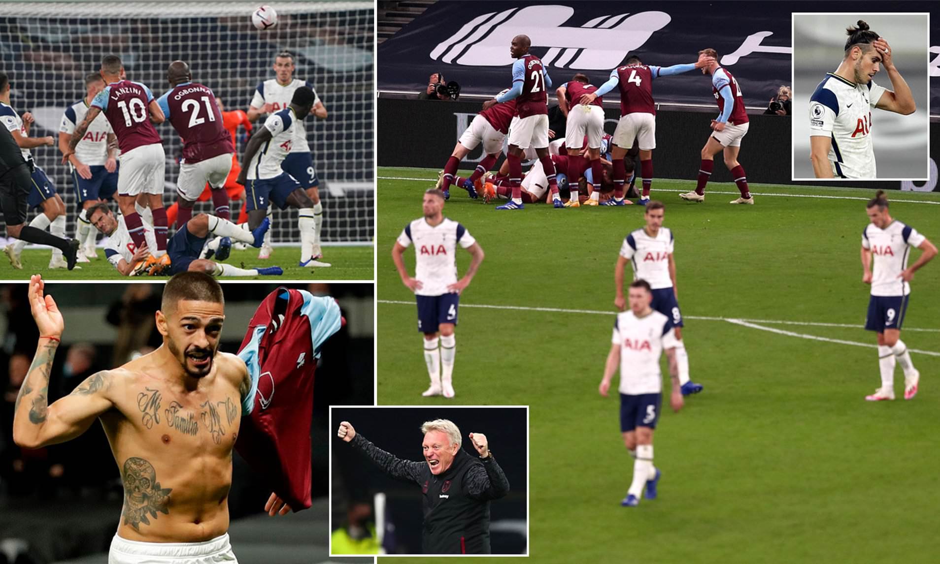 膝蓋傷痛影 膝蓋傷痛影